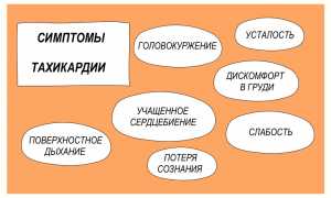 Симптомы тахикардии