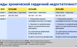 ХСН по МКБ-10