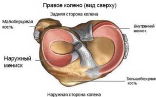 Операция по удалению мениска коленного сустава