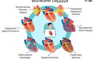 Названия болезней сердца на нервной почве
