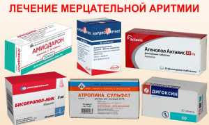 Какие лекарства принимать при аритмии сердца