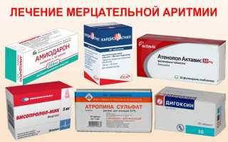 Какие лекарства принимать при аритмии сердца