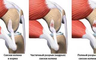 Связки под коленом