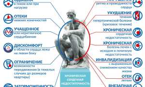 Симптомы и лечение хронической сердечной недостаточности