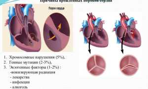 Врожденные пороки сердца у детей как раздел в педиатрии