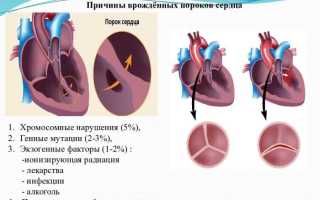 Врожденные пороки сердца у детей как раздел в педиатрии