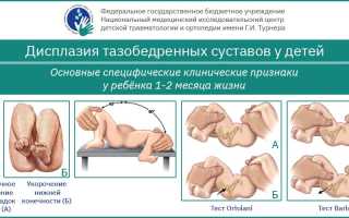 Незрелость тазобедренного сустава у новорожденных