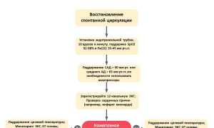 Асистолия сердца: что это такое