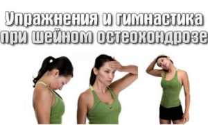Физические и лечебные упражнения при шейном остеохондрозе