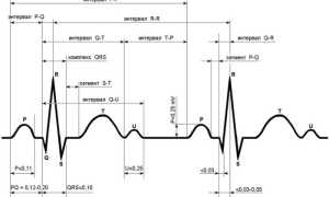 Комплекс QRS на ЭКГ, показатели нормы