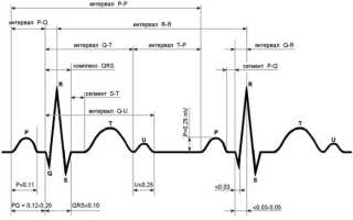 Комплекс QRS на ЭКГ, показатели нормы