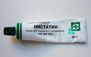 Нистатиновая мазь: для чего ее применяют