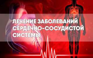 Лечение сердечно-сосудистых заболеваний