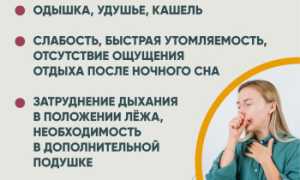 Кашель при сердечной недостаточности: симптомы