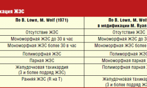 Экстрасистолия желудочковая: код по МКБ-10