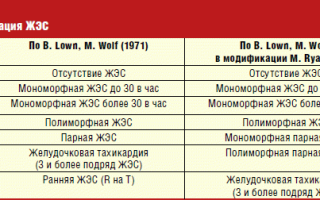 Экстрасистолия желудочковая: код по МКБ-10