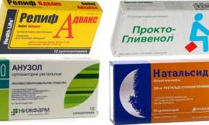 Как вылечить геморрой дома и избавиться от него