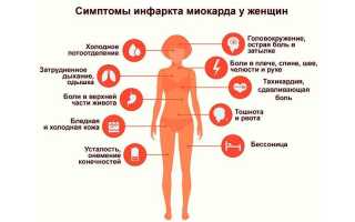 Симптомы сердечного приступа у женщин