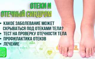 Лечение отёков ног при сердечной недостаточности