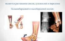 Почему болит голеностопный сустав