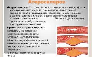 Атеросклероз аорты: этиология, клиника, диагностика, лечение