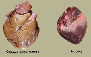 Болезнь бычье сердце