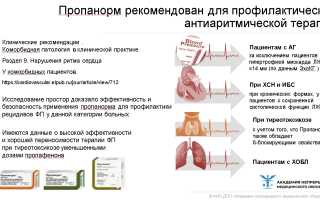 Симптомы и лечение мерцательной аритмии сердца