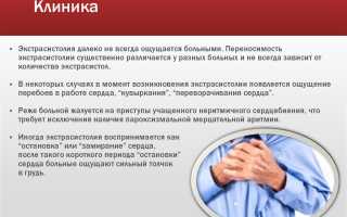 Симптомы экстрасистолии