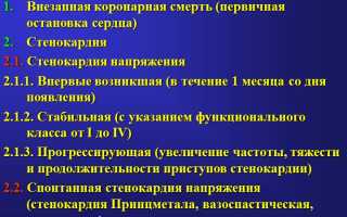 Классификация ИБС