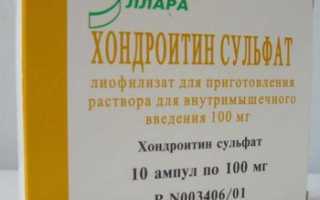 Артрит плюснефалангового сустава