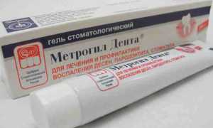 Мазь для десен Метрогил Дента