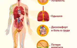 Признаки сердечной недостаточности