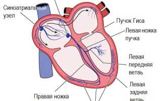 Что такое экстрасистолы в сердце
