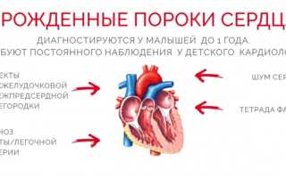Врожденные пороки сердца у детей