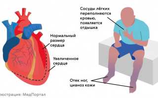 Блокада 1 степени сердца – что это такое?