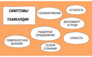 Причины тахикардии